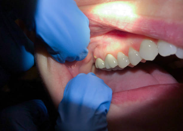 Best Cosmetic Emergency Dentistry in Santa Fe Springs, CA
