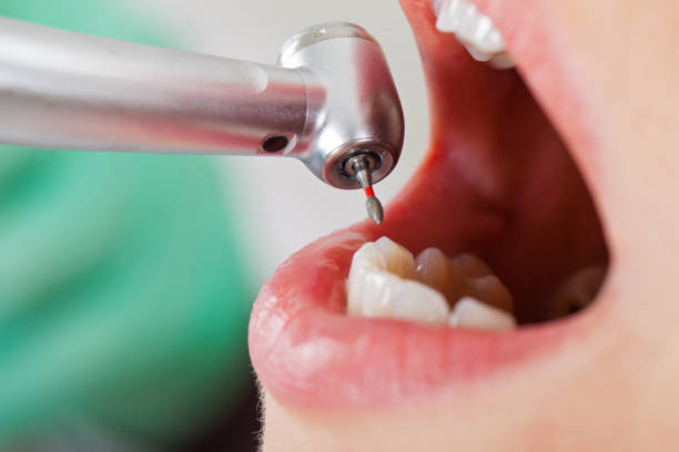 Best Emergency Gum Treatment in Santa Fe Springs, CA